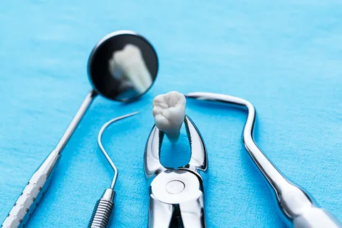 Ten rules to follow before and after the placement of a best dental surgeon in Lahore